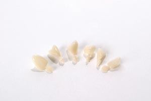 3M Polycarbonate Crowns 100 Upper Right Central 5Bx