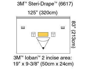 3M STERI-DRAPE PATIENT ISOLATION DRAPES, 1014