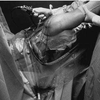 3M STERI-DRAPE U-DRAPES, 1019