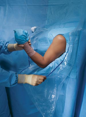 Half Drape 40" x 58" Sterile 60Cs